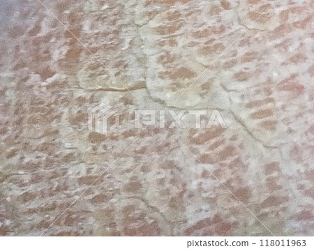 Rough skin 118011963