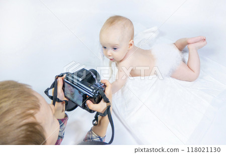 a baby with a hemangioma on his neck lies on a white background 118021130