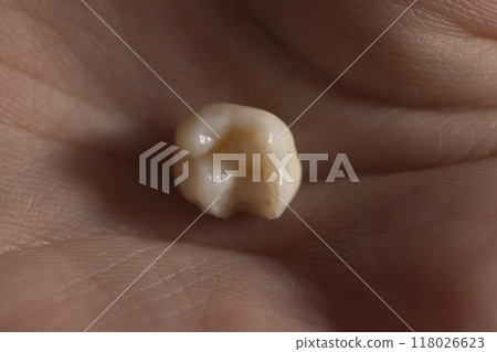 Lost baby teeth in the palm of the hand Lost baby teeth in the palm of the hand 118026623