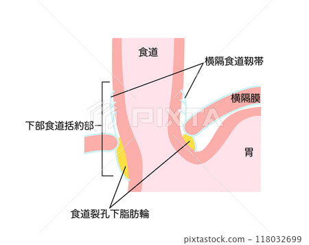 Anatomy and physiology of the digestive system: Lower esophageal sphincter Anatomy and physiology of the digestive system: Lower esophageal sphincter 118032699