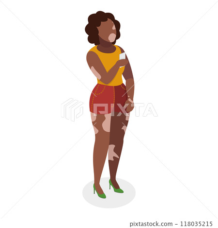 3D Isometric Flat Set of Happy People with Vitiligo. Item 1 3D Isometric Flat Set of Happy People with Vitiligo. Item 1 118035215
