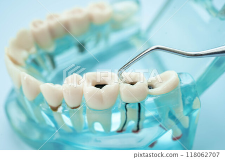 Dentist use dental tool to treatment teeth and gum in patient oral. Dentist use dental tool to treatment teeth and gum in patient oral. 118062707