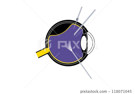 Vitrectomy surgical poster Vitrectomy surgical poster 118071045