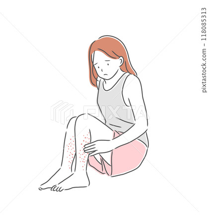腳部皮膚粗糙的女人插畫素材 腳部皮膚粗糙的女人插畫素材 118085313