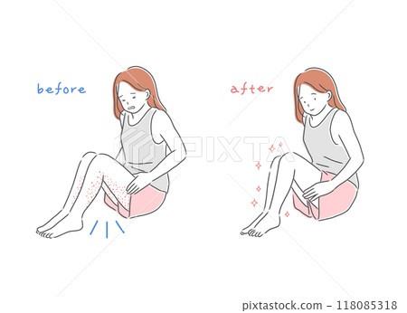 Illustration material of a woman suffering from rough skin on her legs and a woman with beautiful skin 118085318