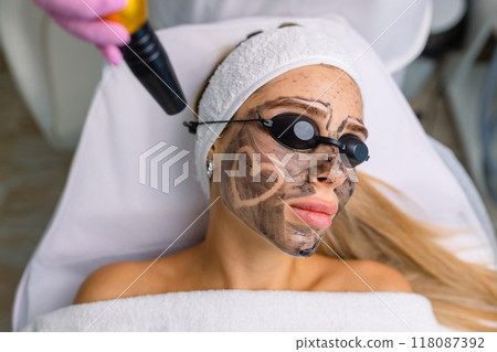 Close-up of cosmetologist's hand making hardware carbon peeling by young pretty customer woman in safety glasses headdress lying on couch in beauty salon. Facial cleaning concept. Cosmetology Services 118087392