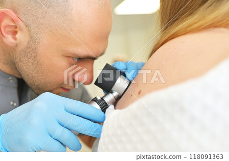 A dermatologist oncologist uses a dermatoscope to examine moles and birthmarks on the patient's body. Melanoma Day, Skin Cancer 118091363
