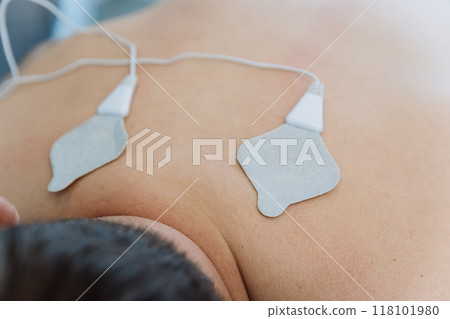 Electrotherapy session with electrodes for back pain relief in a physiotherapy clinic setting Electrotherapy session with electrodes for back pain relief in a physiotherapy clinic setting 118101980