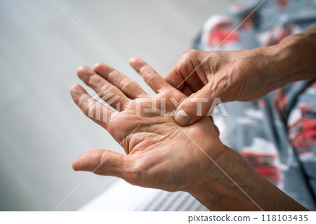 Unseen old woman rubs, feels tender hand with stiff knot under ring finger. Dupuytren contracture 118103435