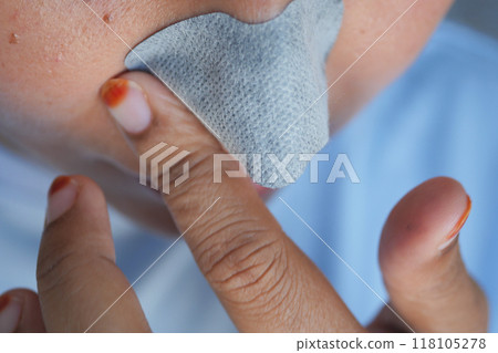 A woman uses a pore strip in her skincare routine to maintain appearance and promote skin health A woman uses a pore strip in her skincare routine to maintain appearance and promote skin health 118105278