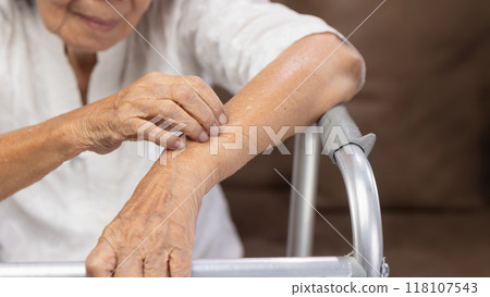 Elderly woman itchy and scratching arm because dry skin. 118107543