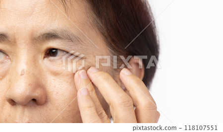 Senior asian woman worry about eye bags and dark spot. 118107551
