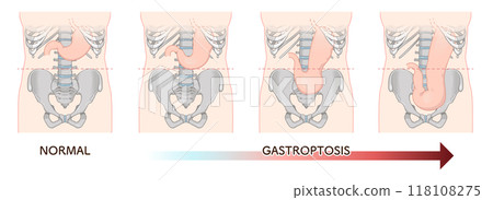 絵画 In my stomach m_9781636914459_fc.jpg