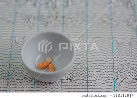 Antiepileptic drugs on EEG graph 118111914