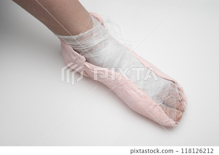 Plaster cast on the leg on a white background. Plaster cast on the leg on a white background. 118126212