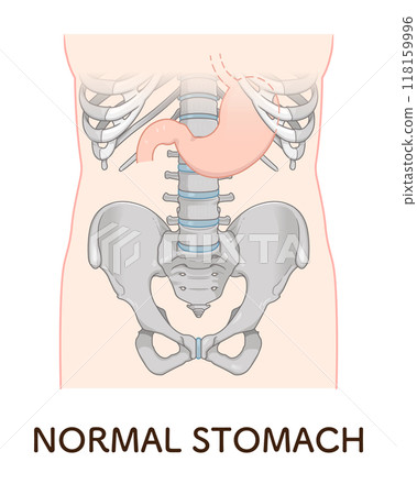 胃下垂,胃,胃無力,胃下垂階段 胃下垂,胃,胃無力,胃下垂階段 118159996