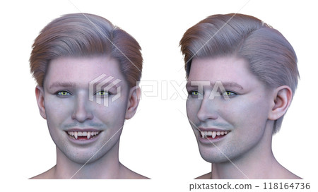 男性吸血鬼臉部特寫 118164736