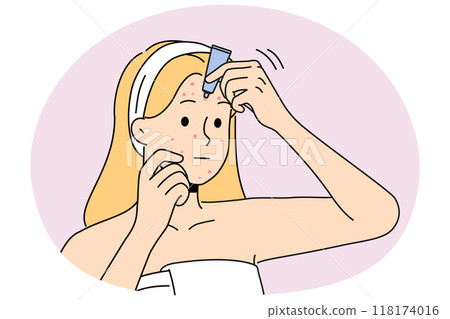 Woman apply cream on pimples on face 118174016