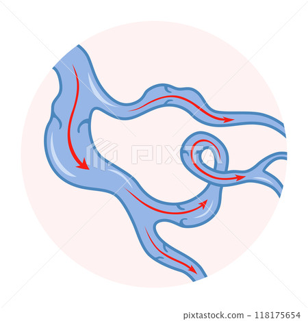 Varicose veins. Blue blood vessel visible through the skin. Vascular disease diagnostic and treatment. Venous insufficiency medical Varicose veins. Blue blood vessel visible through the skin. Vascular disease diagnostic and treatment. Venous insufficiency medical 118175654