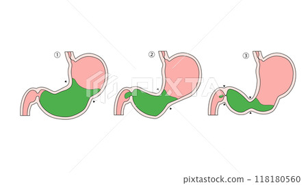 Anatomy and physiology of the digestive system: Peristalsis of the stomach Anatomy and physiology of the digestive system: Peristalsis of the stomach 118180560