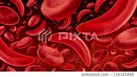 Sickle Cell Disease 118185846