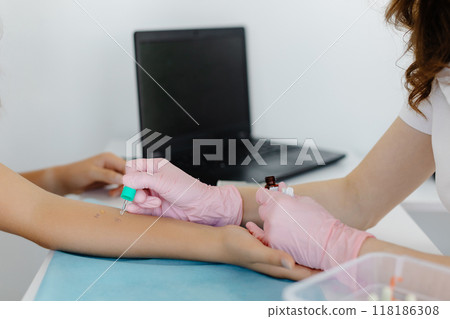 Doctor doing skin allergy test at white table in office. Allergy test - skin prick allergy testing for possible allergens Doctor doing skin allergy test at white table in office. Allergy test - skin prick allergy testing for possible allergens 118186308