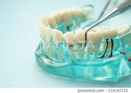 Dental teeth model with dentist tool for dentistry. Dental teeth model with dentist tool for dentistry. 118197132