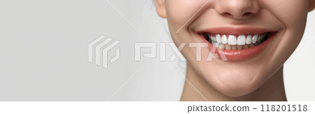 Straightening journey: orthodontic bracket or brace, focusing on dental treatment concept designed to correct misaligned teeth, enhance oral function, boost confidence with beautifully aligned smile. 118201518