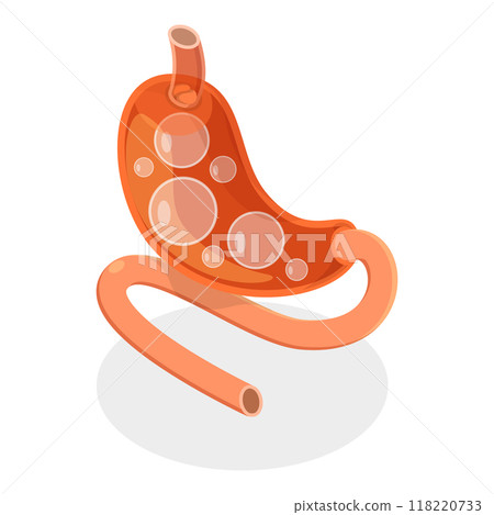 3D Isometric Flat Vector Set of Stomach Problems, Digestive System Issues. Item 5 3D Isometric Flat Vector Set of Stomach Problems, Digestive System Issues. Item 5 118220733