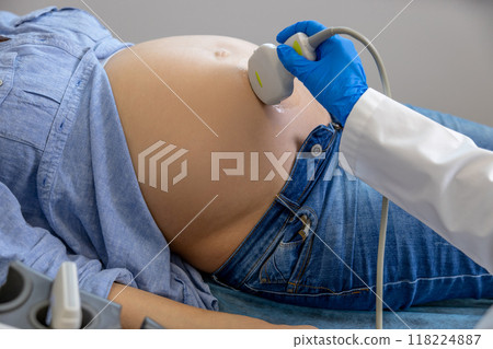 Close up of doctors hand with sensor doing ultrasonography to a pregnant woman 118224887