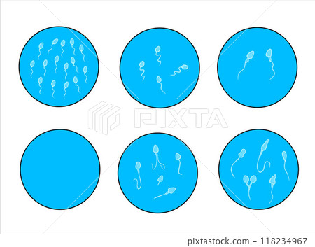 Vector isolated illustration of sperm pathologies. Spermogram. Sperm defects. Defects of the sperm head. Sperm motility. Vector isolated illustration of sperm pathologies. Spermogram. Sperm defects. Defects of the sperm head. Sperm motility. 118234967