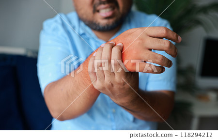 Young man injured his wrist and it was swollen and red. Causes of pain include heavy use, Gout, Rheumatoid arthritis, office syndrome, numbness, and cramp symptoms. Healthcare, medical concept. 118294212