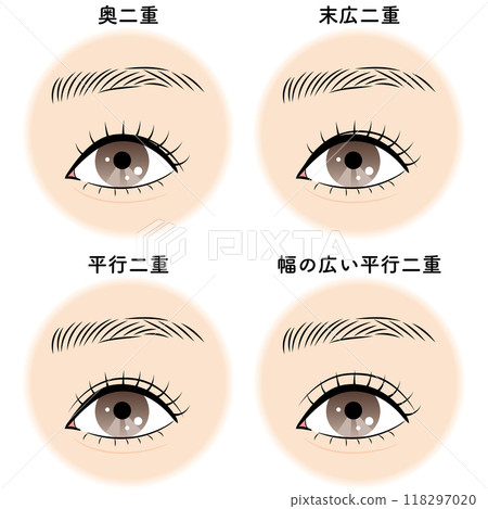 Types of double eyelids 118297020