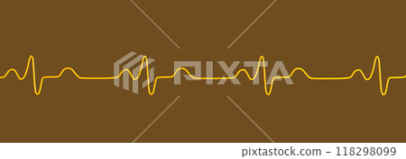 ECG of bundle branch block, 3D illustration 118298099
