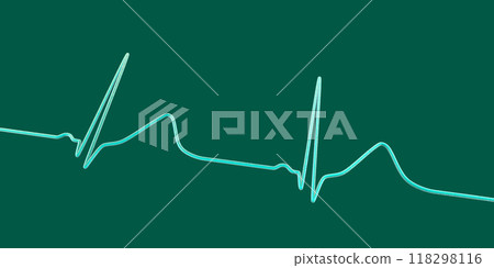 Long QT syndrome ECG, 1st type, 3D illustration Long QT syndrome ECG, 1st type, 3D illustration 118298116