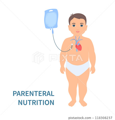 Child receiving parenteral nutrition through a central intravenous access Child receiving parenteral nutrition through a central intravenous access 118308237