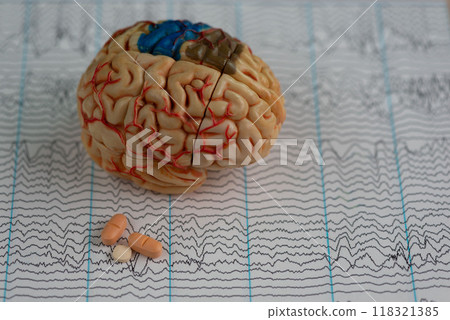 Brain model with antiepileptic medication on EEG 118321385