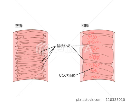 Anatomy and physiology of the digestive system: Jejunum and ileum circular folds 118328010