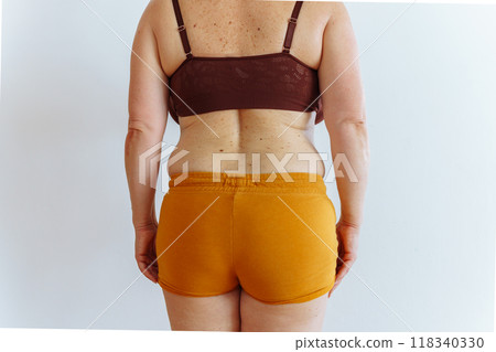 unrecognizable woman showing fat belly with saggy skin unrecognizable woman showing fat belly with saggy skin 118340330