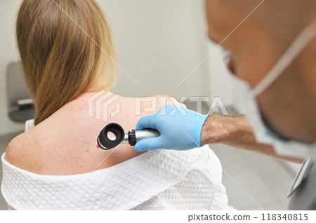 A dermatologist examines neoplasms on the patient's skin using a special dermatoscope device. Prevention of melanoma. A dermatologist examines neoplasms on the patient's skin using a special dermatoscope device. Prevention of melanoma. 118340815
