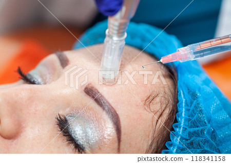 Application of an anti-aging facial rejuvenation cocktail using micro needles. Dermatology concept. Aesthetic medicine concept. Application of an anti-aging facial rejuvenation cocktail using micro needles. Dermatology concept. Aesthetic medicine concept. 118341158
