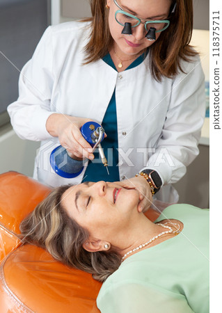 Dermatologist applying cryotherapy for skin lesions on a senior female patient. Dermatologist applying cryotherapy for skin lesions on a senior female patient. 118375711
