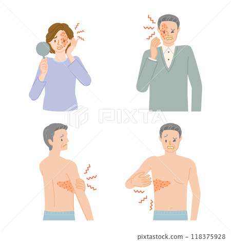 Shingles: illustration set of middle-aged men and women with pain, itching and swelling 118375928