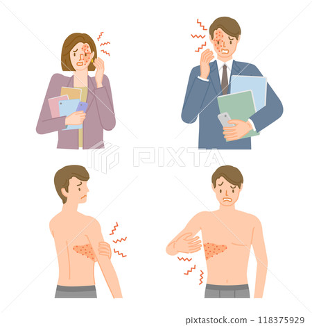 帶狀皰疹：男性和女性疼痛、搔癢和腫脹的插圖集 118375929
