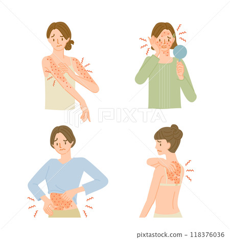 Skin disease: illustration set of a woman with itchy and irritated skin 118376036