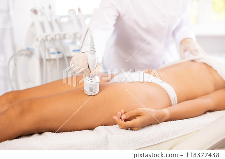 Cosmetologist administering ice hammer therapy to tighten skin on female client thighs 118377438