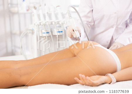 butt skin cleaning beauty procedure butt skin cleaning beauty procedure 118377639
