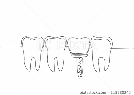 Continuous one line drawing teeth are aligned and one of them is an implant tooth. Do everything to prevent cavities. More caring. World Oral Health Day. Single line draw design vector illustration 118380243