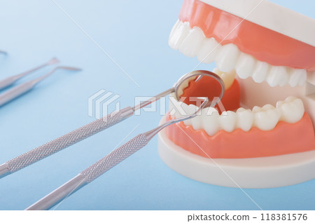 Image of tooth model and dental treatment 118381576