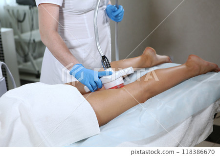 Radio frequency lifting of skin of legs.Hardware cosmetology. Body care. Ultrasonic cavitation procedure for body correction. Anti-cellulite therapy in beauty salon 118386670